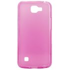 Funda TPU LG K4 Rosa X-One